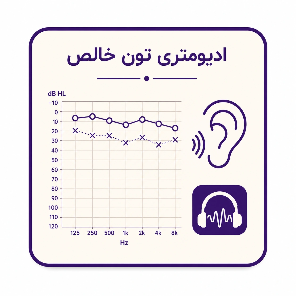 ادیومتری تون خالص