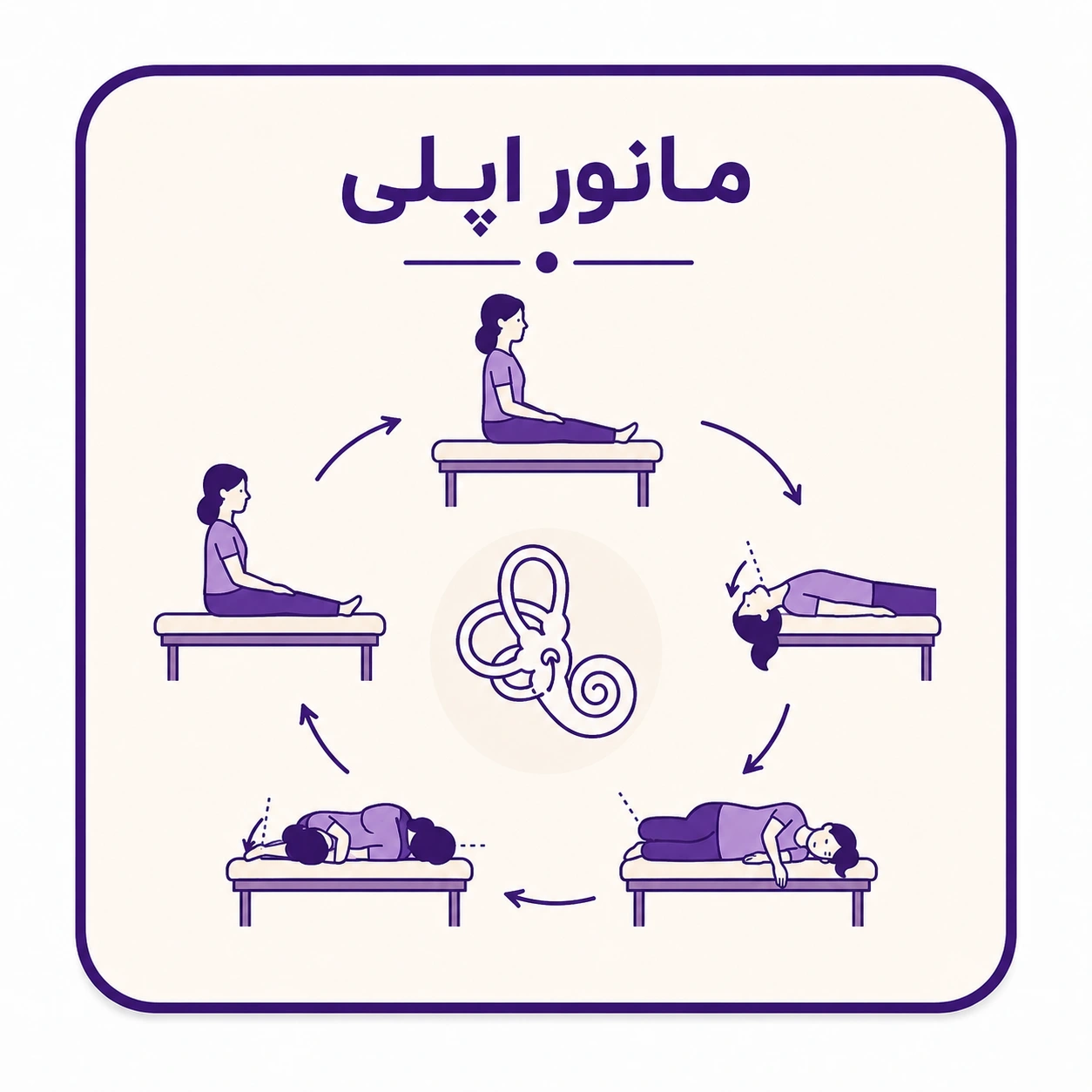 مانور اپلی