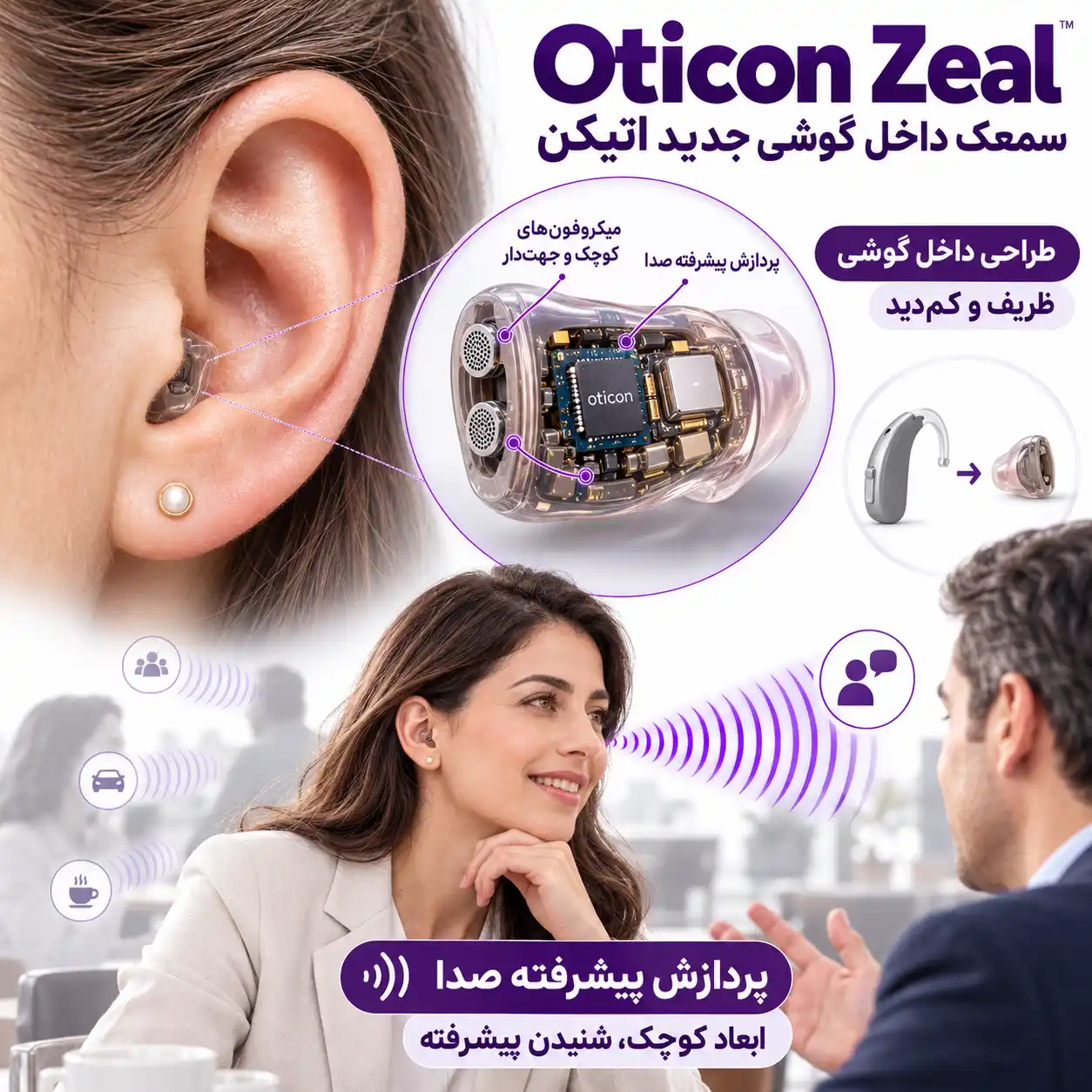 سمعک Zeal اتیکن