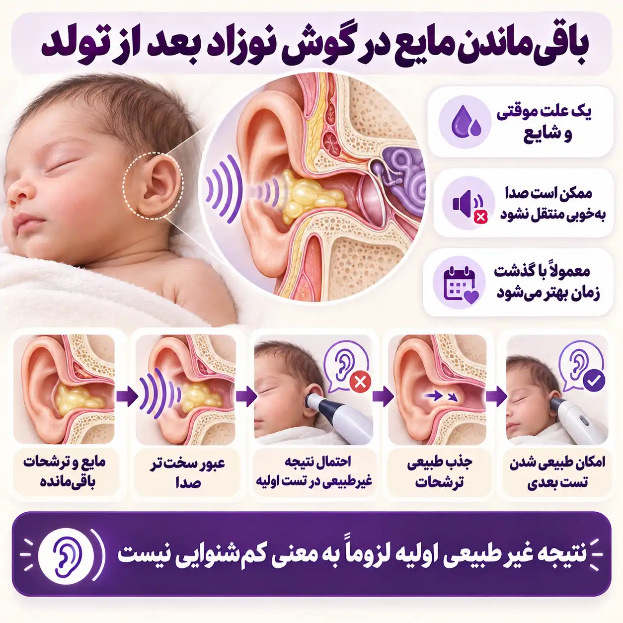 باقی ماندن مایع در گوش نوزاد یکی از دلایل منفی شدن نتایج شنوایی سنجی است.